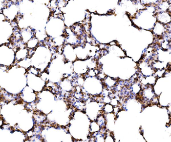 RPL17 Rabbit Polyclonal Antibody