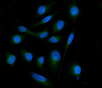 SH3GL2 Rabbit Polyclonal Antibody