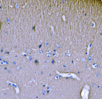 SH3GL2 Rabbit Polyclonal Antibody