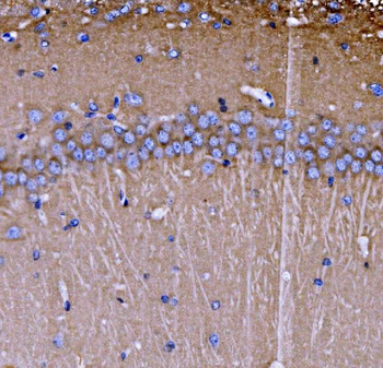 SH3GL2 Rabbit Polyclonal Antibody
