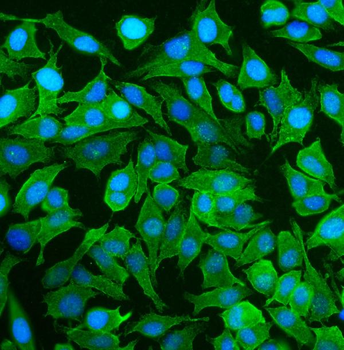 NEAS/SPTAN1 Rabbit Polyclonal Antibody