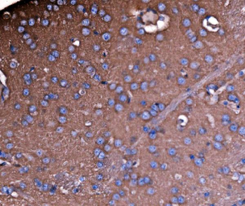 NEAS/SPTAN1 Rabbit Polyclonal Antibody