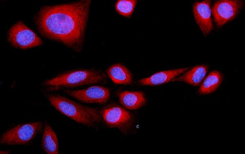 SRP72 Rabbit Polyclonal Antibody