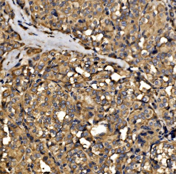 SRP72 Rabbit Polyclonal Antibody
