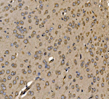 SRP72 Rabbit Polyclonal Antibody