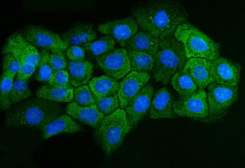 ADORA2B Rabbit Polyclonal Antibody