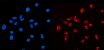 AKAP 95/AKAP8 Rabbit Polyclonal Antibody