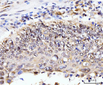 AKAP 95/AKAP8 Rabbit Polyclonal Antibody