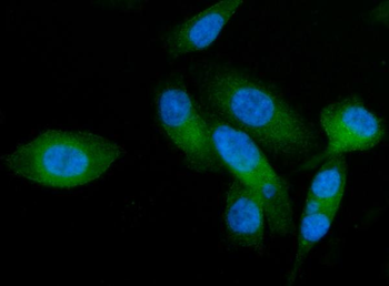 AP2A2 Rabbit Polyclonal Antibody