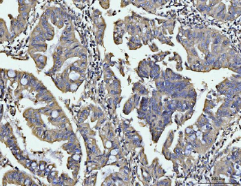 BIN1 Rabbit Polyclonal Antibody