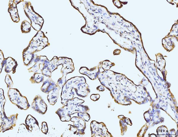 BZW2 Rabbit Polyclonal Antibody