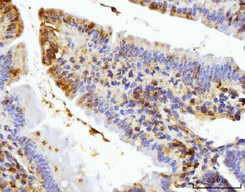BZW2 Rabbit Polyclonal Antibody