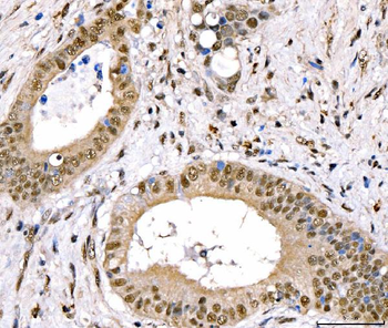 CRTC3 Rabbit Polyclonal Antibody