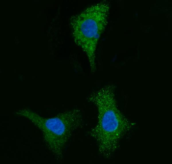 CYB5B Rabbit Polyclonal Antibody