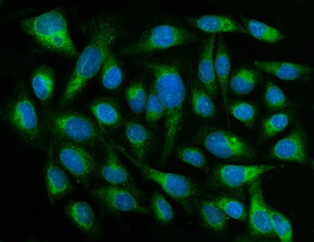 CYB5R3 Rabbit Polyclonal Antibody