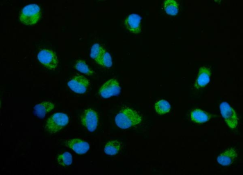 ECSIT Rabbit Polyclonal Antibody