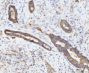 ECSIT Rabbit Polyclonal Antibody