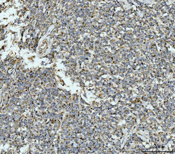 ECSIT Rabbit Polyclonal Antibody