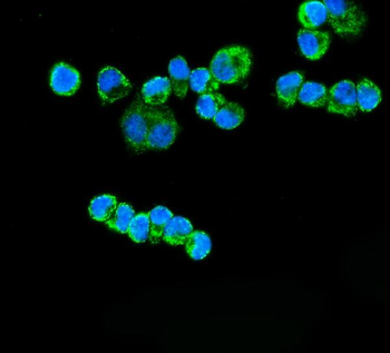 ETFA Rabbit Polyclonal Antibody