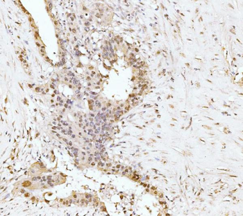 RRP4/EXOSC2 Rabbit Polyclonal Antibody