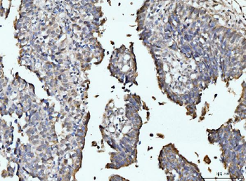 RRP4/EXOSC2 Rabbit Polyclonal Antibody