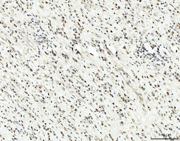 RRP4/EXOSC2 Rabbit Polyclonal Antibody