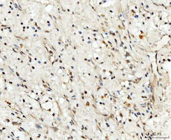 RRP4/EXOSC2 Rabbit Polyclonal Antibody