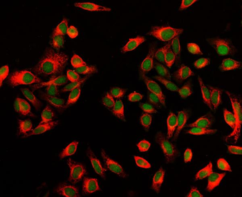 EXOSC8 Rabbit Polyclonal Antibody