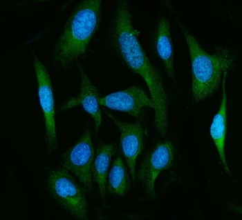 FAAH1/FAAH Rabbit Polyclonal Antibody