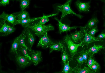 Fibrillarin/FBL Rabbit Polyclonal Antibody
