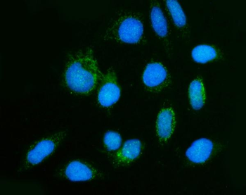 GHITM Rabbit Polyclonal Antibody