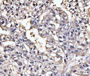 GHITM Rabbit Polyclonal Antibody