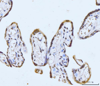 GHITM Rabbit Polyclonal Antibody