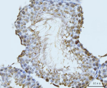 GHITM Rabbit Polyclonal Antibody