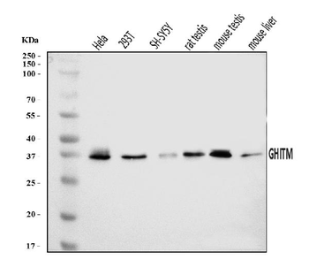 GHITM Rabbit Polyclonal Antibody