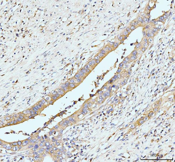 GIT1 Rabbit Polyclonal Antibody