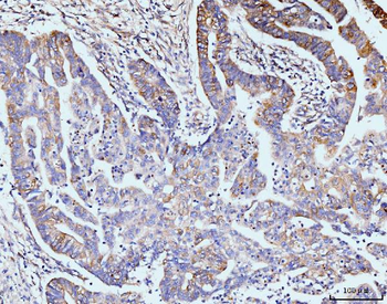 GIT1 Rabbit Polyclonal Antibody