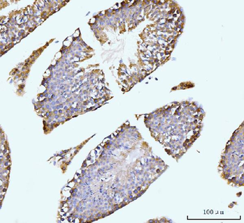 GIT1 Rabbit Polyclonal Antibody