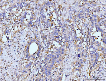 GLUL Rabbit Polyclonal Antibody
