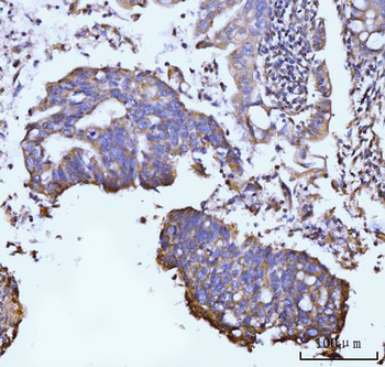 GLUL Rabbit Polyclonal Antibody