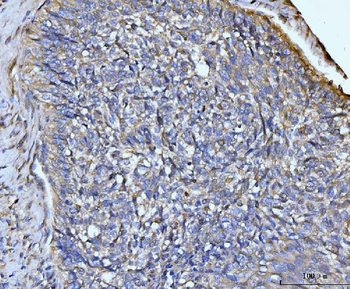 GLUL Rabbit Polyclonal Antibody