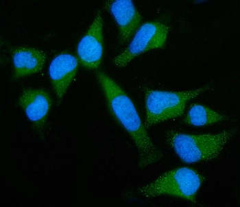 GNB3 Rabbit Polyclonal Antibody