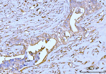 GNB3 Rabbit Polyclonal Antibody