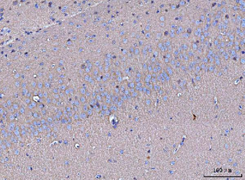 GNB3 Rabbit Polyclonal Antibody
