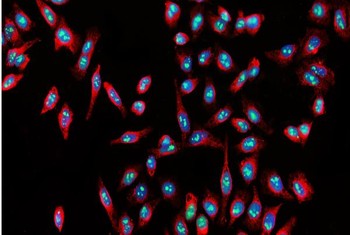 Nucleostemin/GNL3 Rabbit Polyclonal Antibody