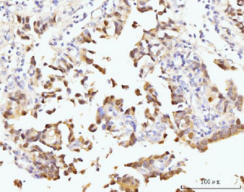 Nucleostemin/GNL3 Rabbit Polyclonal Antibody