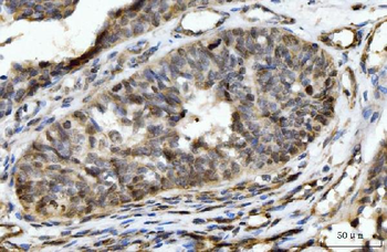 HES5 Rabbit Polyclonal Antibody
