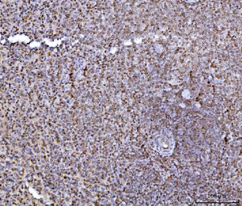 HES5 Rabbit Polyclonal Antibody