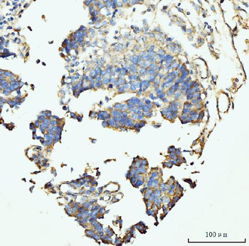 GRPEL1 Rabbit Polyclonal Antibody