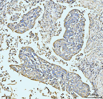 GRPEL1 Rabbit Polyclonal Antibody